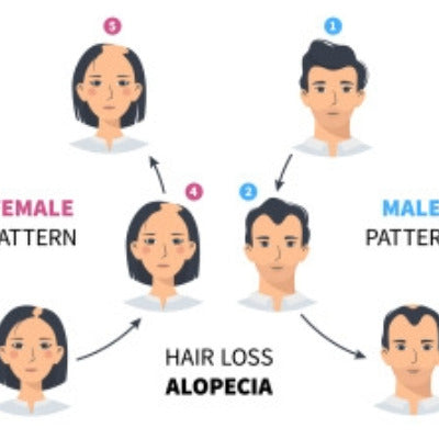 Hair Loss